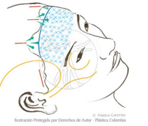 Colombia forehead stretch