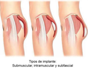 tail surgery colombia