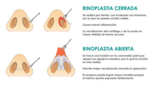 nose surgery colombia